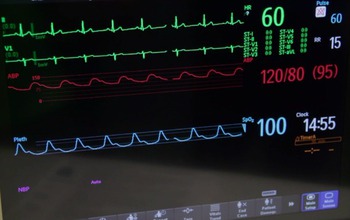 monitor showing heart rate